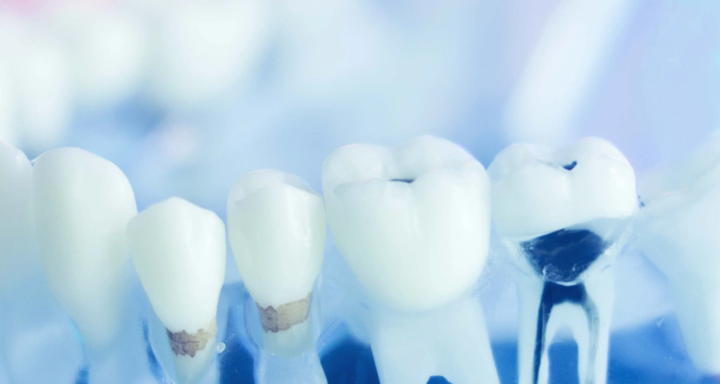 ©QUEENSLANDENDODONTICSDentalSpecialistsSERVICESEndodonticRetreatment